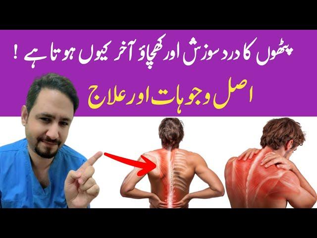 Myalgia Muscle Pain Treatment In Urdu Hindi - Dr Irfan Azeem