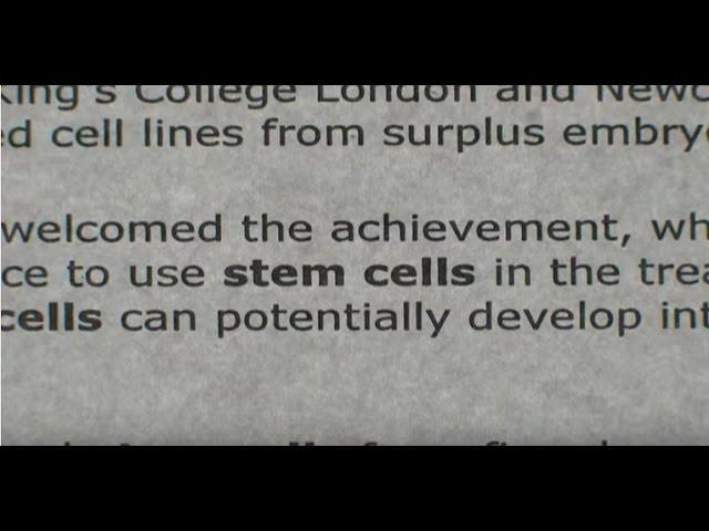 A Stem Cell Story