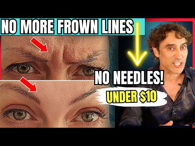 QUICKLY and EASILY GET RID OF YOUR FROWN LINES