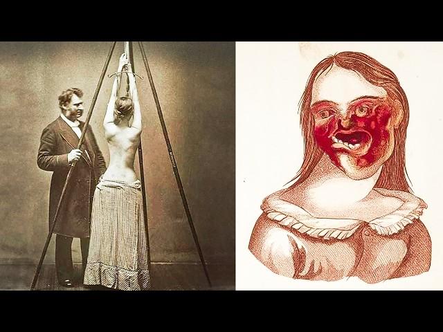 5 Creepy Ancient Medical Procedures (PART 2)