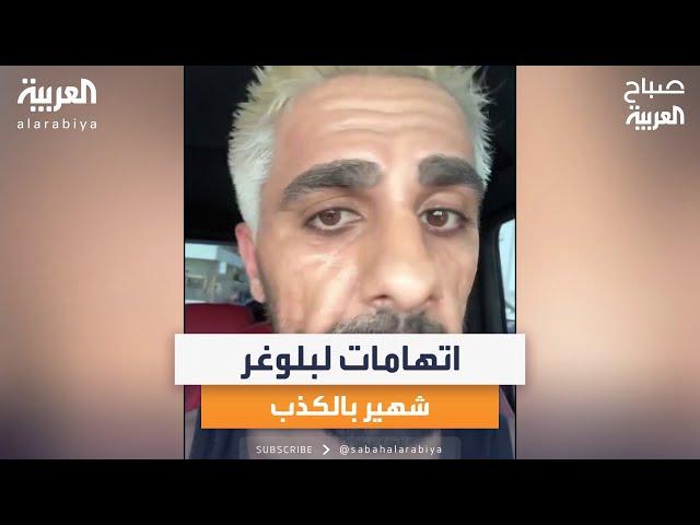 صباح العربية | اتهامات لليوتيوبر "مو فلوغز" بالكذب بعد فيديو الوجه المنقبض