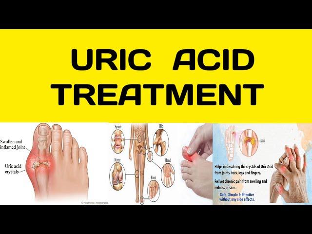 Uric Acid Treatment in Telugu | Gout Treatment