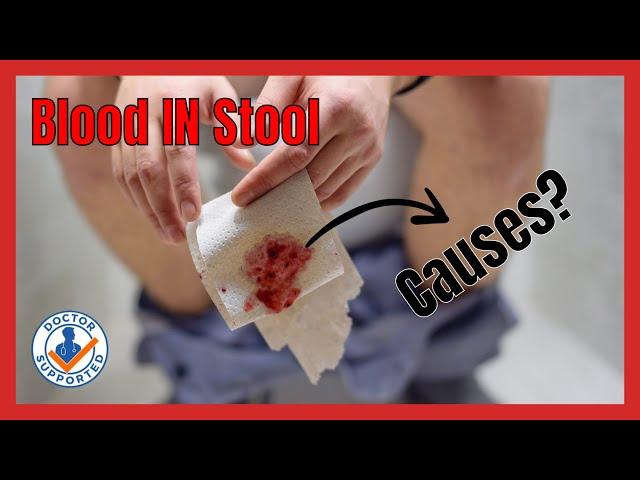 Understanding Blood in Stool: Expert Insights by Dr. Umair