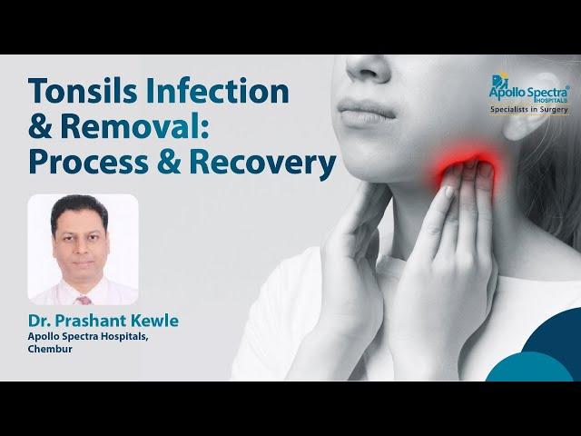 Tonsil infection – Causes & Treatments | Apollo Spectra