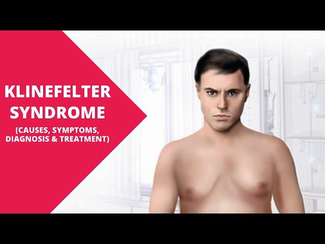 Klinefelter Syndrome: Understanding the Genetic Condition