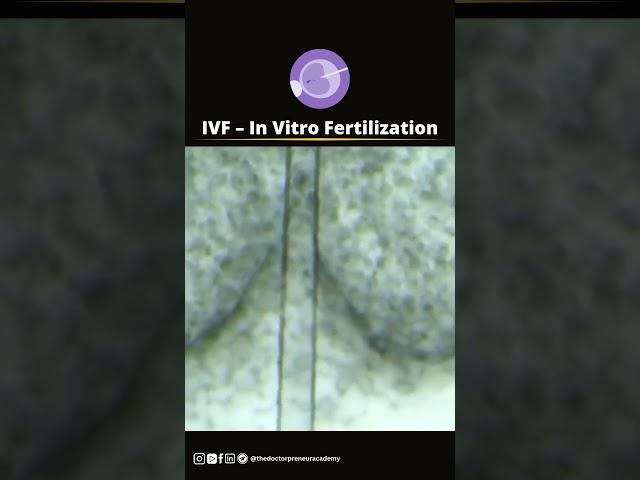 In vitro fertilization (ivf)