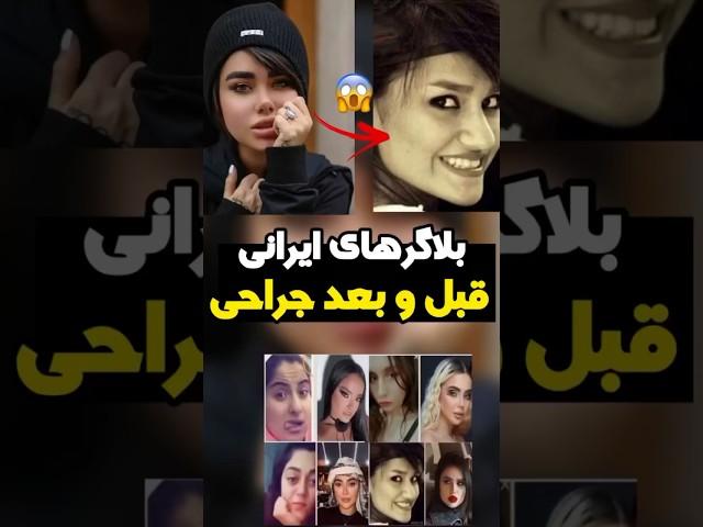 بلاگرهای معروف ایرانی قبل و بعد از عمل زیبایی!!| فکت و دانستنی!!| #shorts