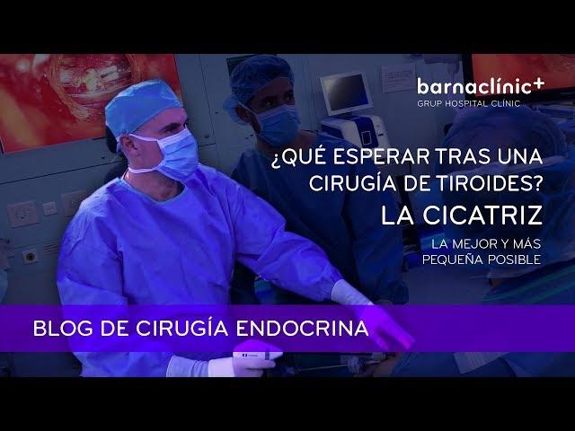 La CICATRIZ después de la CIRUGÍA DE TIROIDES: la mejor y más pequeña posible