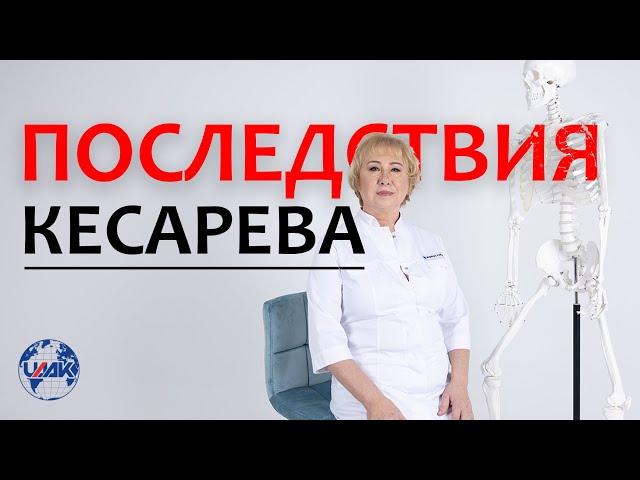 Кесарево сечение - каковы последствия? (проф.Васильева)