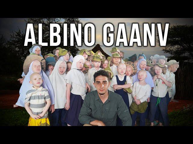 Tanzania Mein Secret Albino Village Mei Jana (Bahut safed hai jeene ke liye)