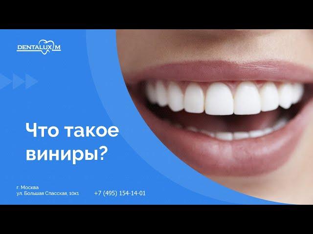  Что такое виниры?