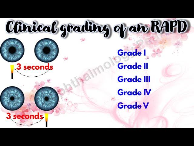 Pupil 4 | Clinical grading of an RAPD | Marcus Gunn Pupil