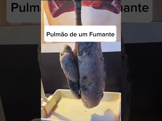 Veja o que o cigarro faz com o Pulmão #anatomia #pulmão #medicina