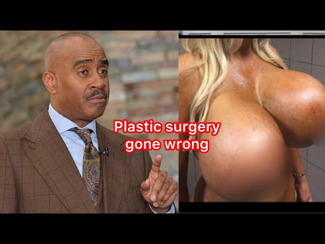 Pastor Gino Jennings plastic surgery gone wrong