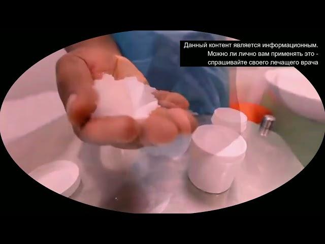 Трофические язвы