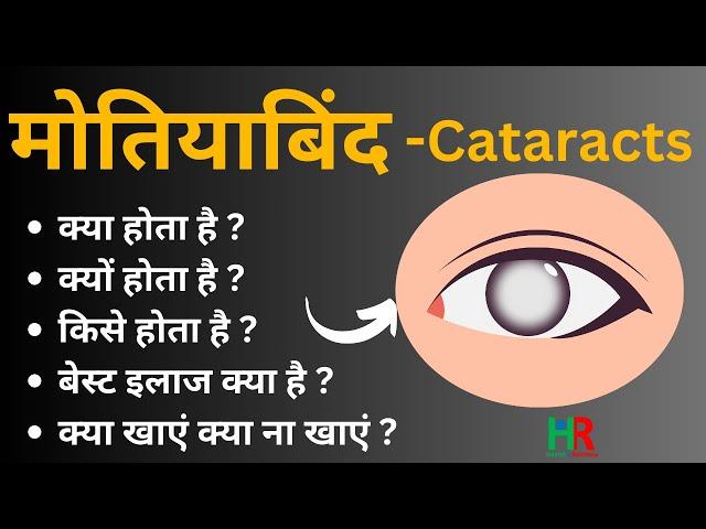 मोतियाबिंद के शुरूआती लक्षण और कारण क्या होते हैं || cataract complete information in hindi ||