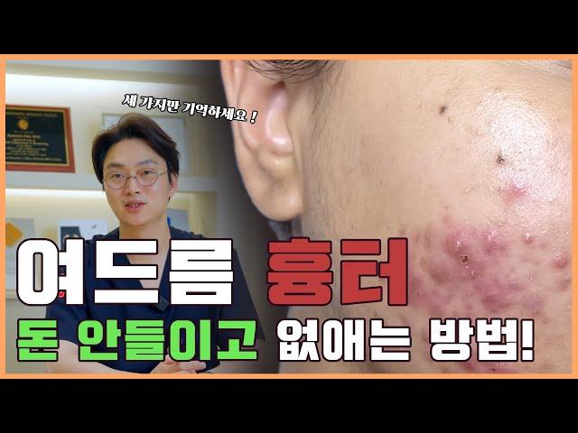 피부과 의사가 알려주는 여드름흉터없애는 방법|여드름 흉터가 생기는 이유와 집에서 할 수있는 방법 알려드립니다.