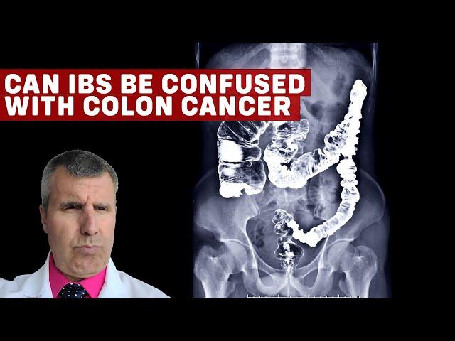 IBS vs. Colon Cancer: Understanding the Differences and Similarities