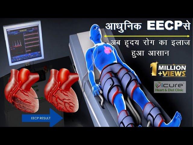 Best EECP Therapy: Open Heart's Arteries Naturally (No Surgery!) #eecp #eecptherapy