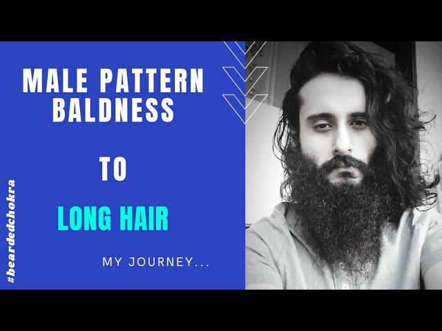 Male Pattern Baldness To Long Hair Naturally - My Journey | Hair Growth Phase | Bearded Chokra