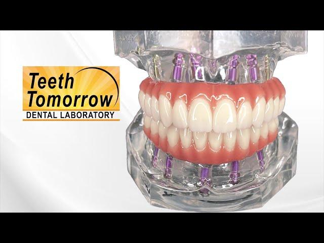 Teeth Tomorrow Dental Lab Overview