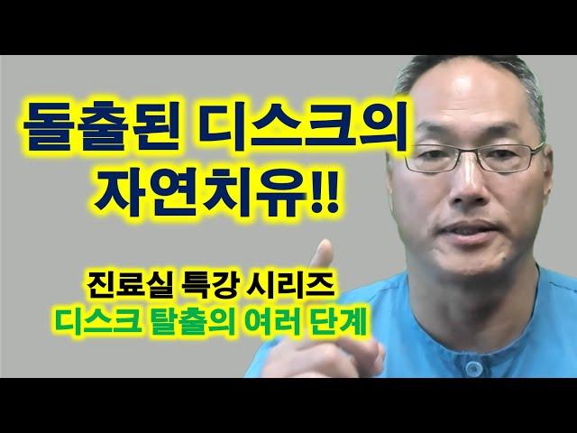 돌출된 디스크의 자연치유!!!