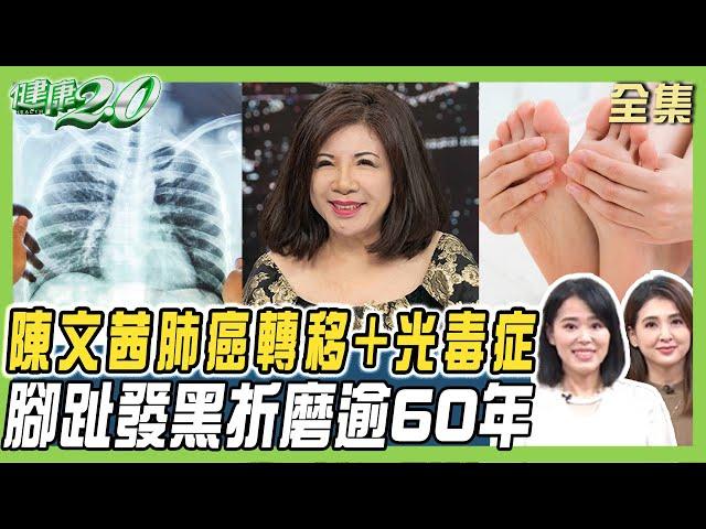 陳文茜肺癌轉移又光毒症 腳趾發黑折磨逾60年！紅斑性狼瘡攻擊心肺腎 女赴瑞安樂死！ 健康2.0 20241214【完整版】陳欣湄 韋汝 蔡昀臻 柳朋馳 洪素卿 彥寬 羅珮琳