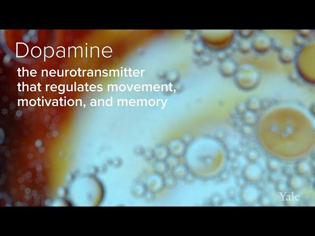 Understanding the Role of Dopamine in Parkinson's Disease - Yale Medicine Explains