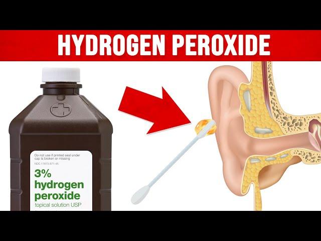 9 Unexpected Benefits of Hydrogen Peroxide