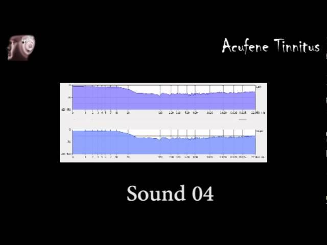 Sound 4 - fast tinnitus relief - sollievo acufene rapido