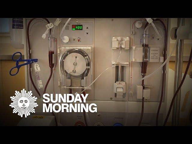 Kidney dialysis industry accused of maximizing profits over patients