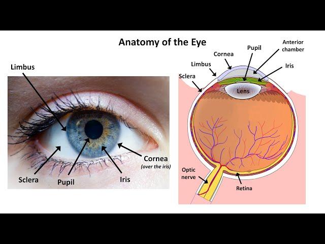 An Approach to a Red Eye