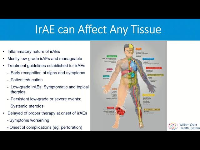 Updates on Cancer Immunotherapy Webinar - Massey Nematollahi