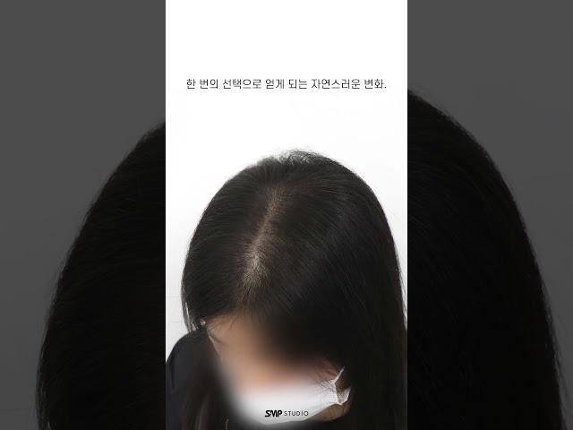 휑한 머리 계속 방치하실건가요? #smp #탈모 #인천두피문신 #두피문신 #여성탈모