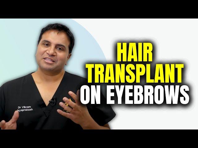 Eyebrow Hair Transplant