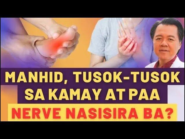 Manhid, Tusok-Tusok sa Kamay at Paa: Nerve Nasisira Ba? - By Doc Willie Ong