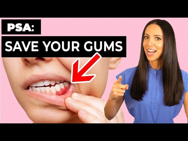 These 4 Things Can SAVE Your GUMS (You Still Have Time!)