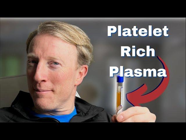 Platelet Rich Plasma PRP for Hair Loss (androgenic alopecia): My Journey