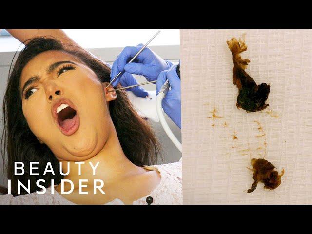 How Earwax Is Professionally Extracted | Beauty Explorers | Insider Beauty