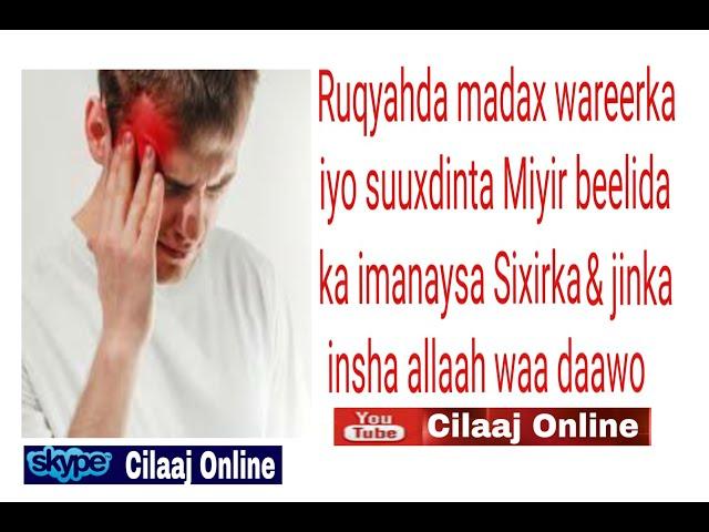 Ruqyahda madax wareerka iyo suuxdinta Miyir beelida ka imanaysa Sixirka & jinka Isha insha allaah