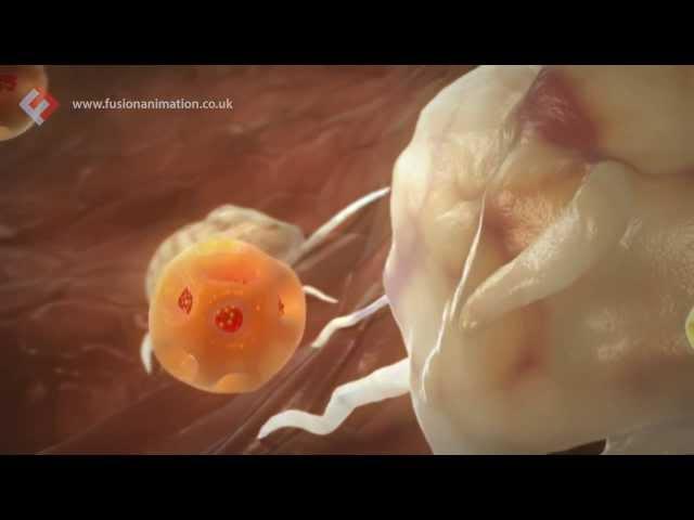 Fusion Medical Animation Showreel 2013