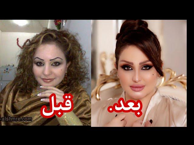 شهد الشمري قبل وبعد التجميل صدمة كبيرة