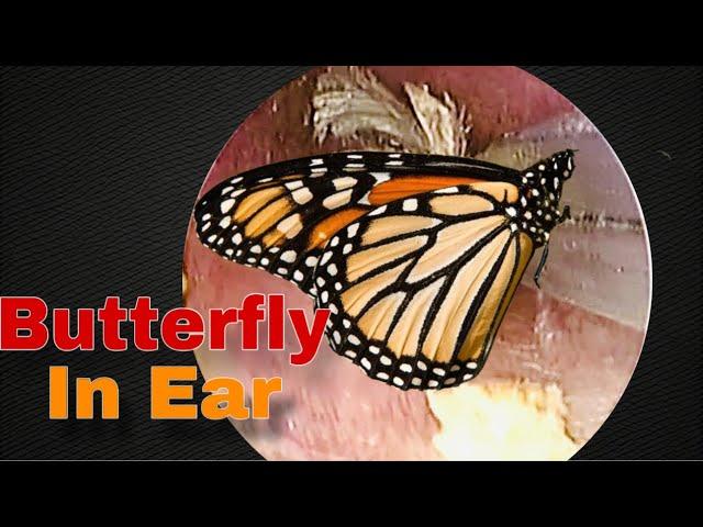 How did the butterfly fly into the ear? | Doctor Anh