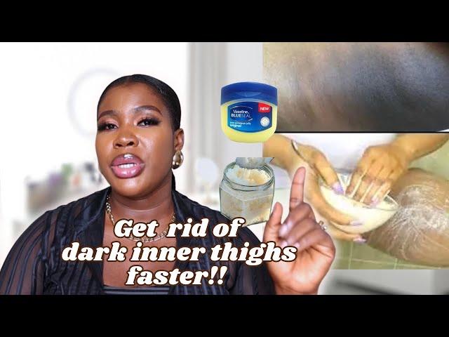 HOW TO GET RID OF DARK INNER THIGHS / BIKINI LINES FASTER NATURALLY