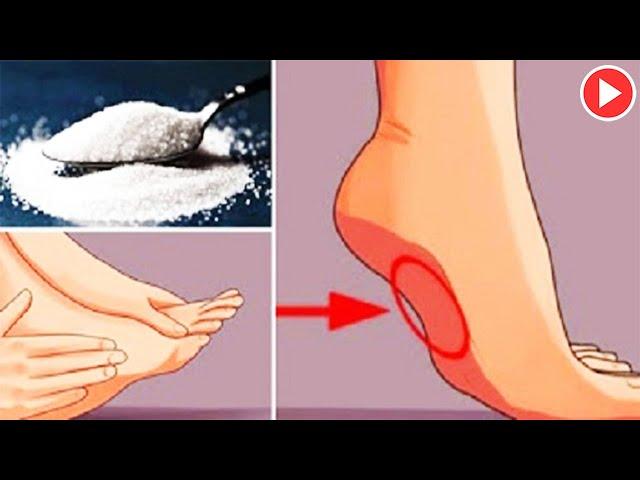 5 Signs You Are Eating Too Much Sugar | How To Prevent Sugar Cravings - Remedies One