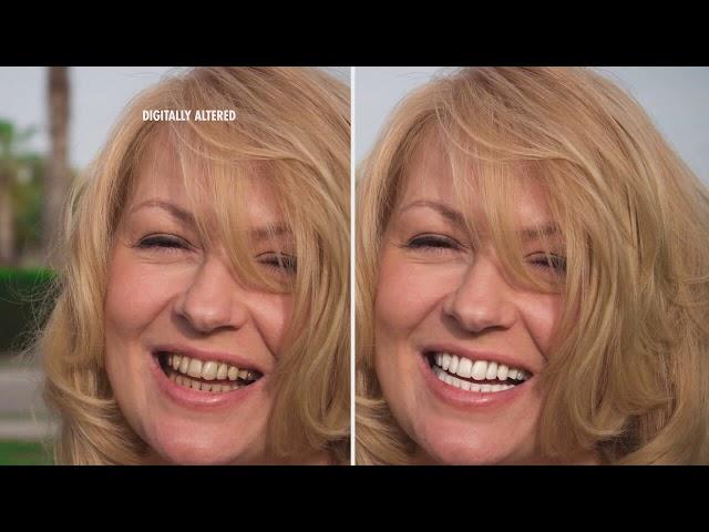 A Whiter Smile In 5 Minutes