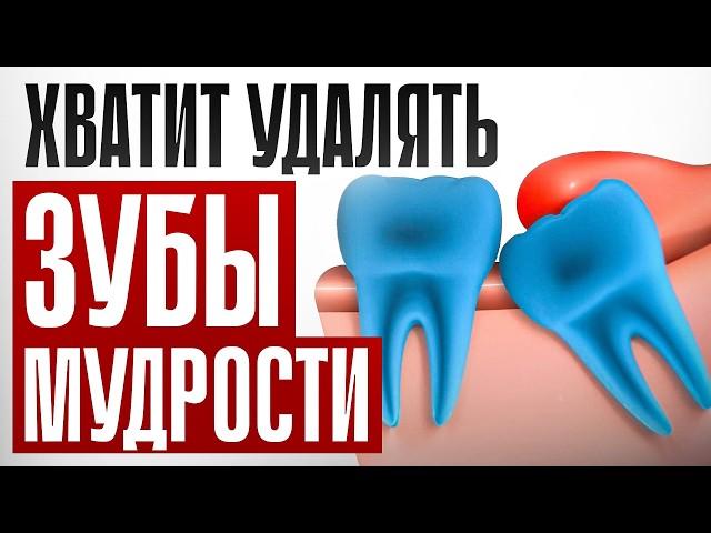 Зубы мудрости: ОСТАВИТЬ нельзя УДАЛИТЬ / От этого решения зависит твоё здоровье