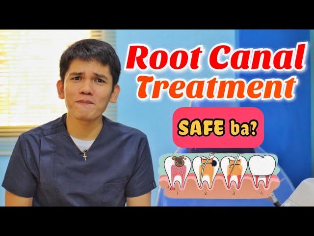 ROOT CANAL THERAPY: Safe ba?