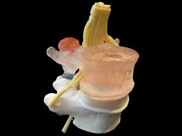 Academic LxH anatomical spine model by Dynamic Disc Designs Corp.