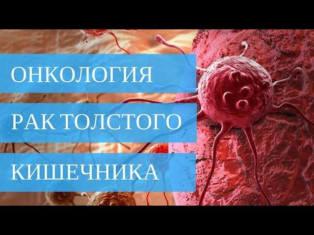 РАК ТОЛСТОГО КИШЕЧНИКА - лечение без операции!